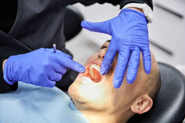 Best Emergency Broken Tooth Repair in Feather Sound, FL