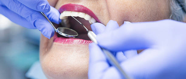 Best Walk-In Emergency Dentist in Feather Sound, FL